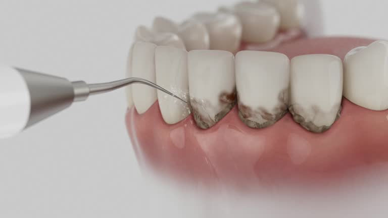 Trusted Root Canal Treatment service in Oaklyn, NJ - Dentist Open Now